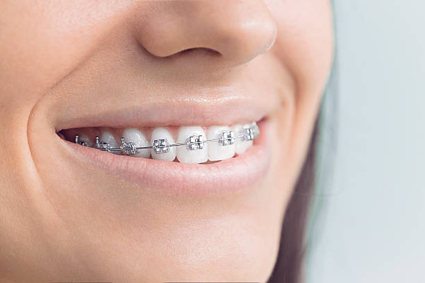 Laser Dentistry in Santa Ynez, CA